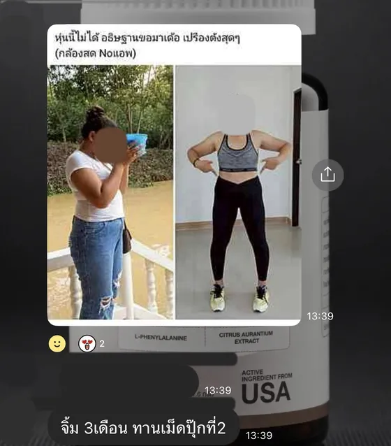 รีวิวลูกค้า ภาพก่อนและหลัง จิ้มสามเดือนแล้วมาต่อแบบเม็ดกระปุกที่สอง