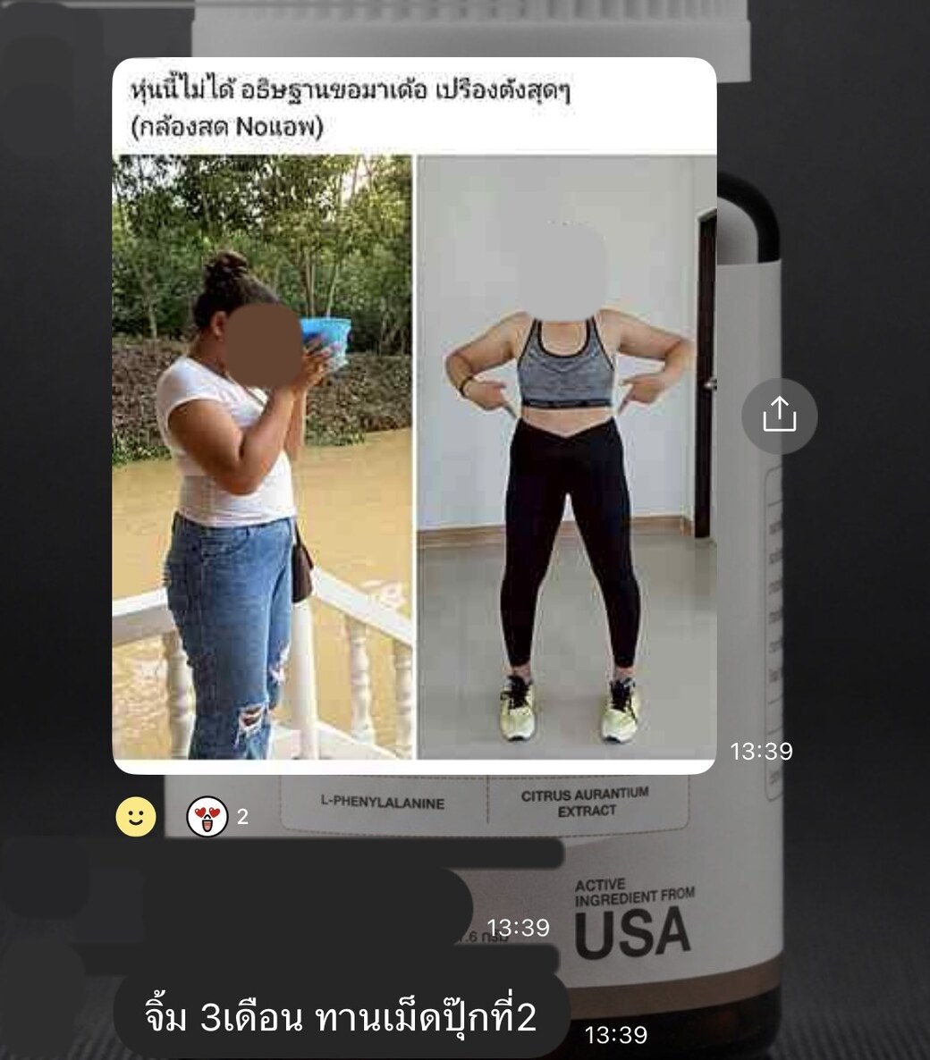รีวิวลูกค้า ภาพก่อนและหลัง จิ้มสามเดือนแล้วมาต่อแบบเม็ดกระปุกที่สอง